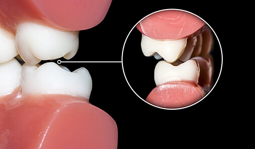 噛めないが「噛める」に変わる